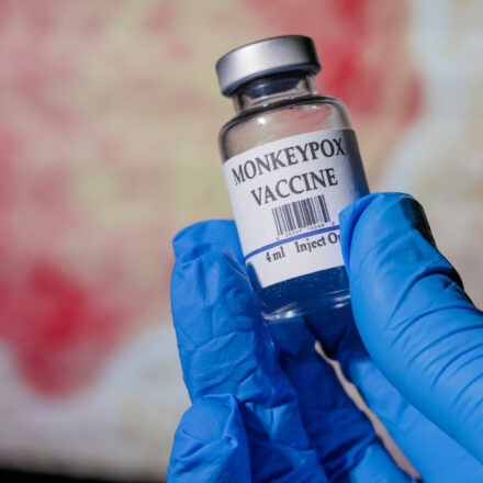 How Should Employers Respond to the Monkeypox Public Health Emergency?